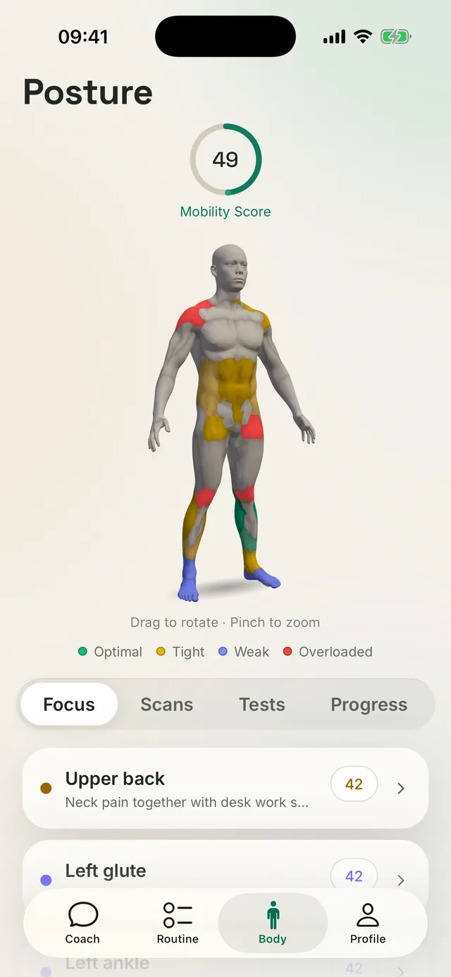 Schermata di Kallen: modello 3D del corpo con le zone rigide e sovraccariche evidenziate e un elenco di priorità