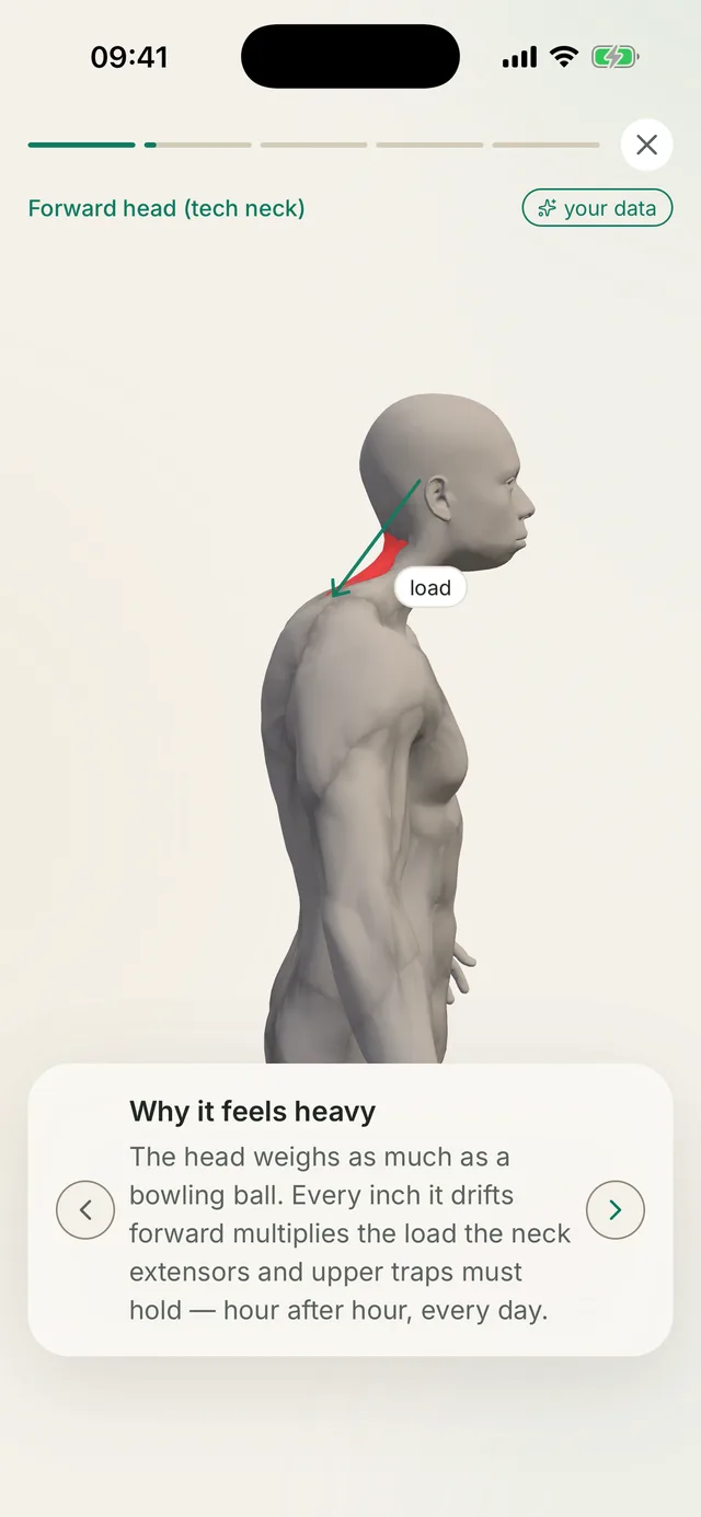 Schermata di Kallen: un’animazione sul modello 3D (Posture Story) che spiega lo schema posturale